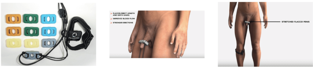 BEST-PENIS-STRETCHERS-DEVICES-EXTENDERS-TOP-TRUTH-ONLY-HERE-STILL-ON-EXTENDER-REVIEW-RESULTS-PEYRONIE-DISEASE-PENIS-EXTENDER-ALFA-STALLION